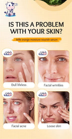 Skin Care - SADOER Milk Fruits Facial Serum - Orange